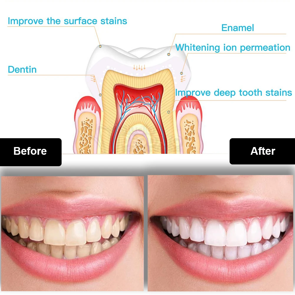 Diş Diş Beyazlatma Kiti Mini 1 - Teeth Whitening Pens incelemesi ve fiyatı